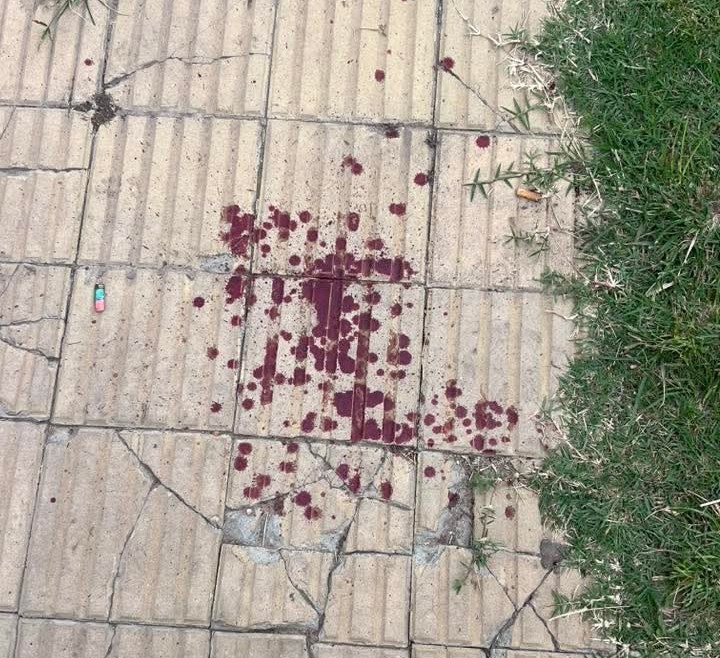 Violento ataque en Barrio Cabot: una mujer fue herida de un piedrazo y le robaron el celular